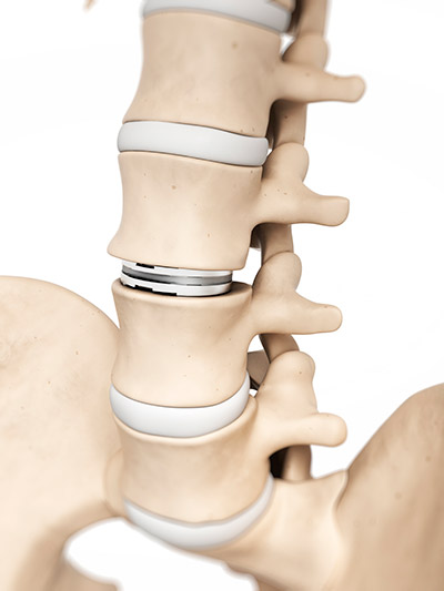 Medical Device Cleaning